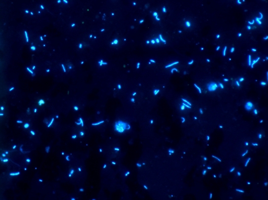 La comunità batterica vista al microscopio ad epifluorescenza