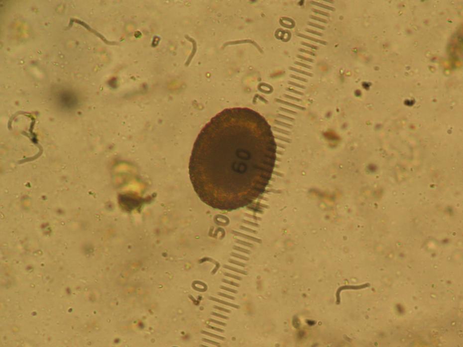 foto al microscopio dell'uovo di Ascaris laevis